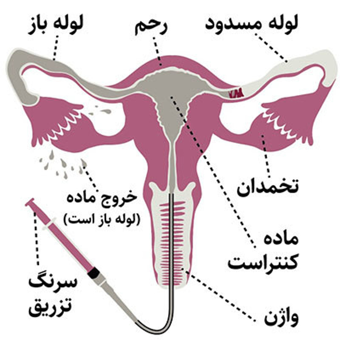 w/عکس رنگی رحم چیست؟