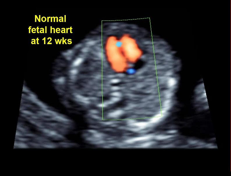 eco/اکوی قلب جنین