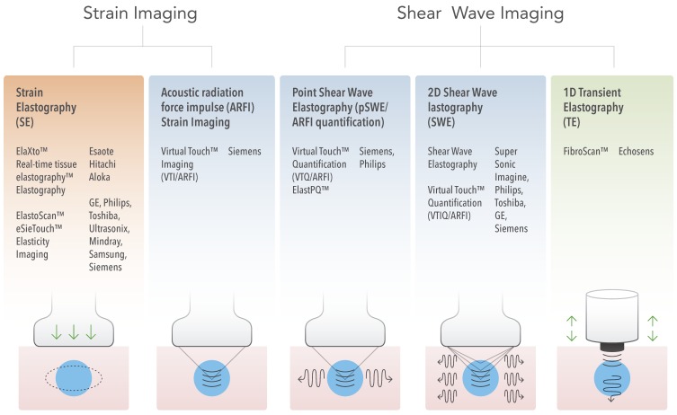 elastography/الاستوگرافی