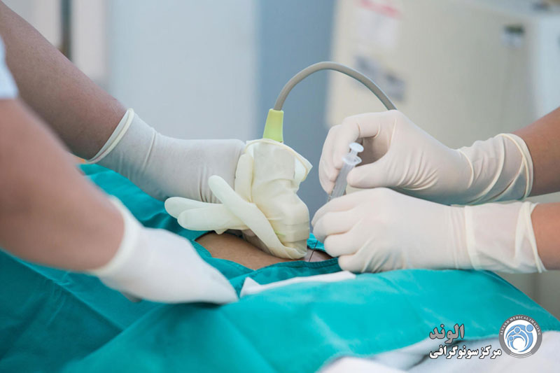 d/آمنیوسنتز چیست و چه کاربردی دارد؟