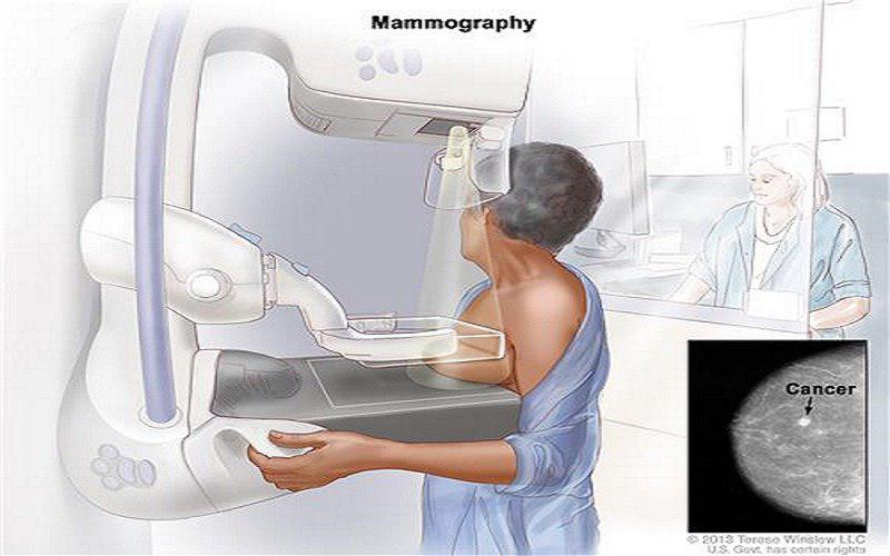 a/ماموگرافی چیست؟
